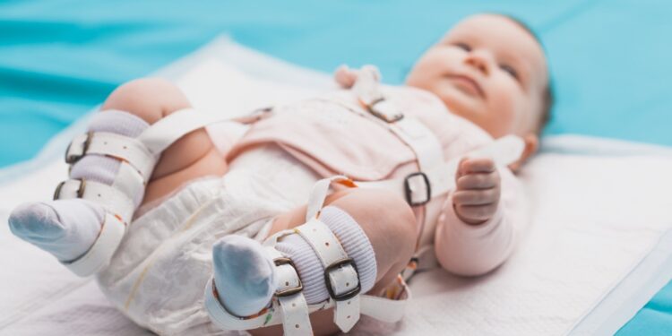 Orangtua Harus Tahu, Kenali Gangguan Hip Dysplasia pada Bayi