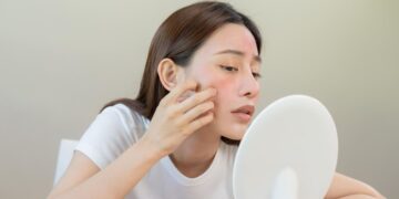 Pentingnya Menjaga Kesehatan Kulit