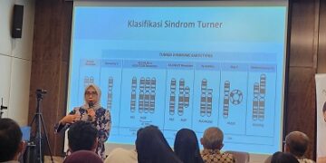Tantangan Terbesar Penanganan Turner Syndrome Ada pada Keterlambatan Diagnosis