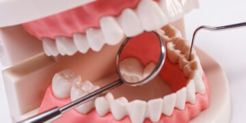 Sakit Gigi Tak Kunjung Sembuh? Root Canal Treatment Bisa Menjadi Solusi untuk Menyelamatkan Gigi Asli