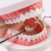 Sakit Gigi Tak Kunjung Sembuh? Root Canal Treatment Bisa Menjadi Solusi untuk Menyelamatkan Gigi Asli
