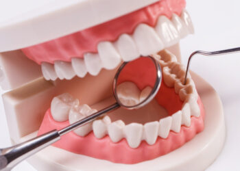 Sakit Gigi Tak Kunjung Sembuh? Root Canal Treatment Bisa Menjadi Solusi untuk Menyelamatkan Gigi Asli
